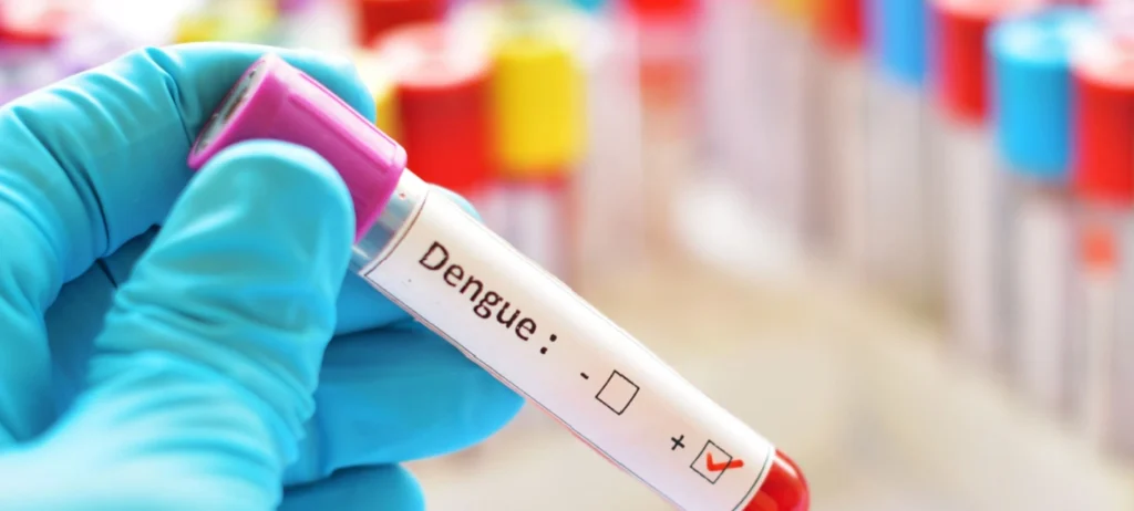 Diante da explosão de casos da dengue, quem tem plano de saúde pode fazer teste se tiver sintomas como febre alta de manchas no corpo?