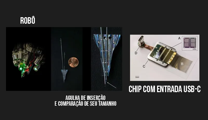 Elon Musk, Neuralink